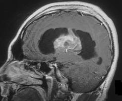 font: fundacionannavazquez.wordpress.com